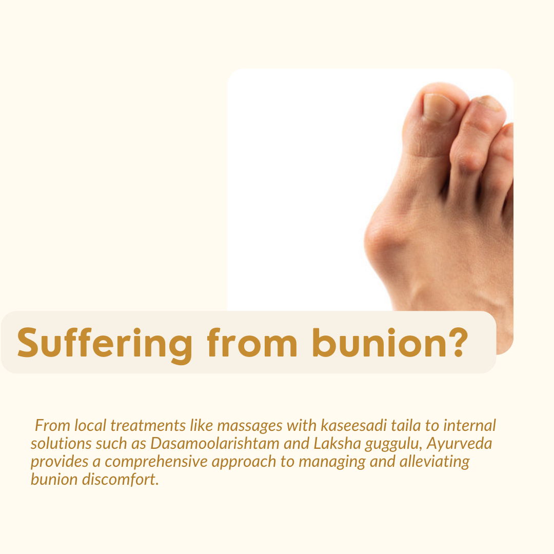 ayurvedic treatment for bunions